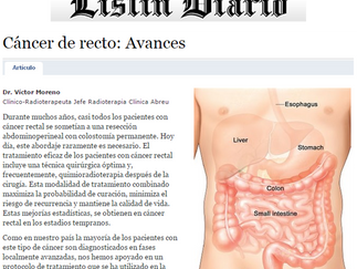 Listín Diario: Cáncer de recto, Avances   