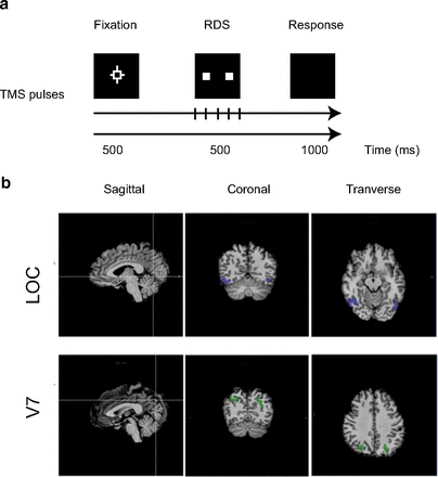 Nicole's TMS work is out!