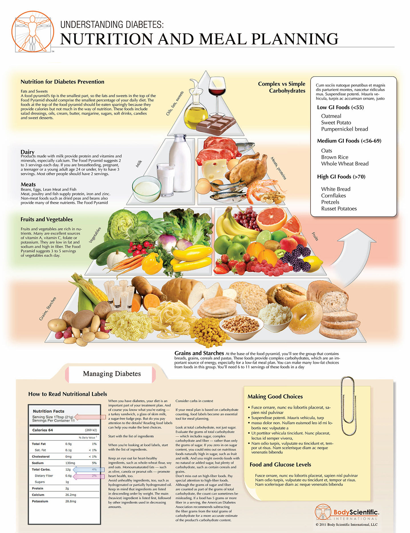 Nutrition for Type 2 Diabetes - Anatomical Wall Chart