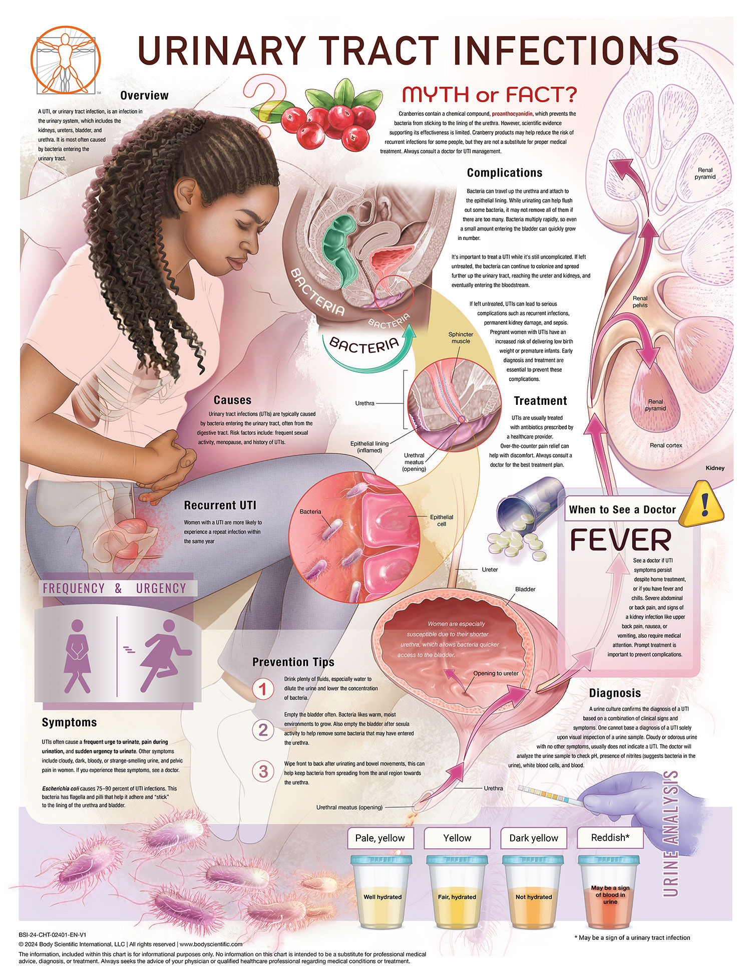 Urinary Tract Infection