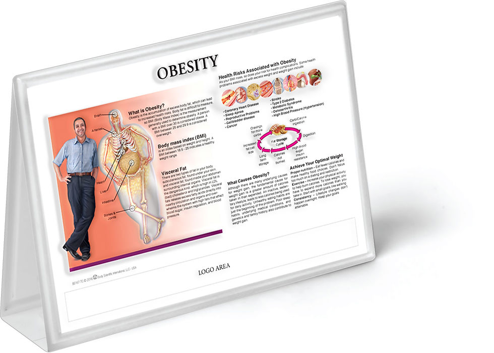 Obesity - Anatomical Tent Chart