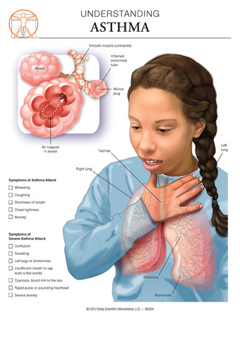 Asthma - Anatomical Wall Chart | BSI Catalog