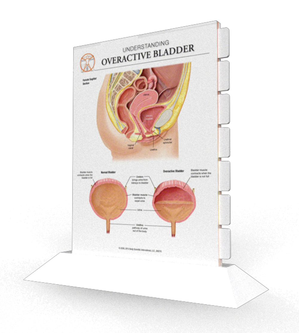 Overactive Bladder - Multi-tab Slider Model