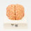 Thumbnail: BRAIN WITH ARTERIES 2 PARTS