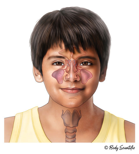 Medical illustration of young  Hispanci girl with sinuses depicted