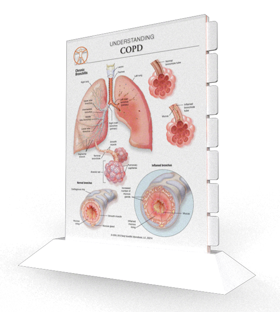 COPD - Multi-tab Slider Model