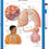 Understanding Asthma - Wipe-off Easel