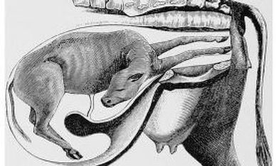 Williams Obstetrics 1917 p514 -cropped.jpg