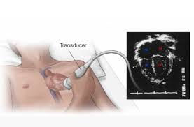 what is 2D Echo? Why is 2D Echo Important for Cardiac Patients?