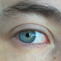 Brigid Flanagan's eye