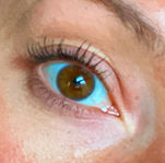 Kendall Snee's eye