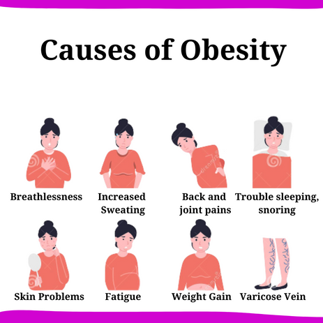 Causes of Obesity