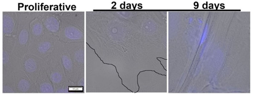Human neonatal primary keratinocyte.jpg