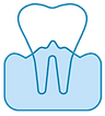 Gum disease