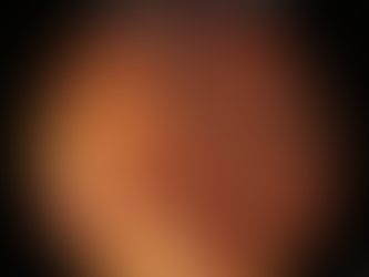 Outriders: Como Derrotar o Acari Derretido