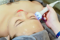 Tixel skin resurfacing.jpg
