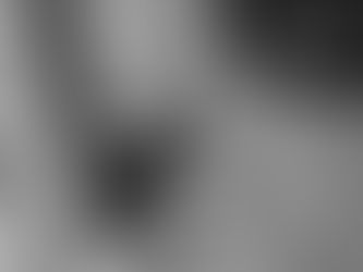 TRACK FEATURE: LOWER COMPANION - "INJURED"