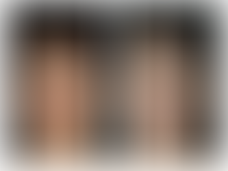 🌸 Le rajeunissement cutané sans chirurgie : la nouvelle ère de la beauté naturelle