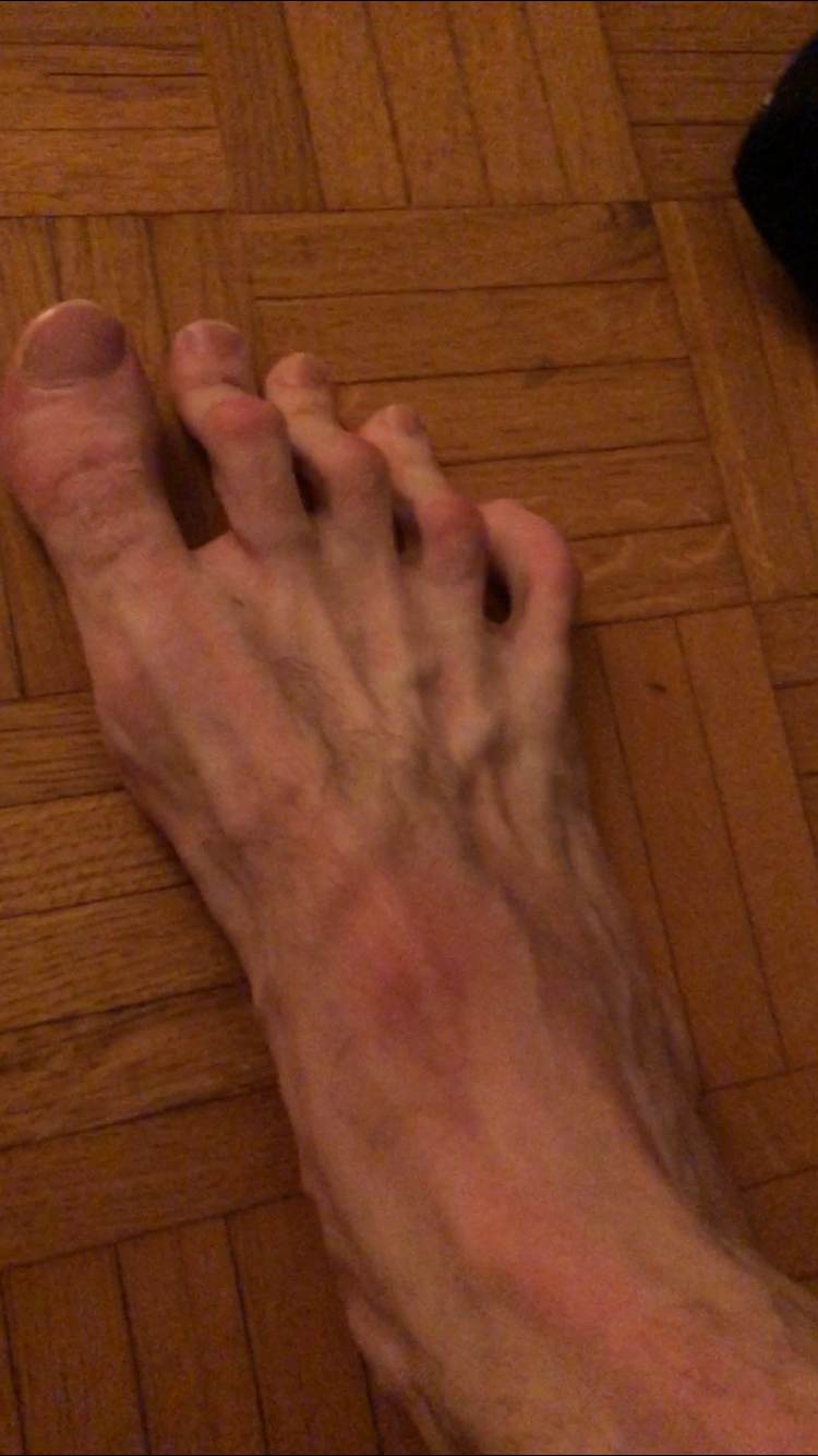 Thumbnail: Chemist45 compares his size 18 feet