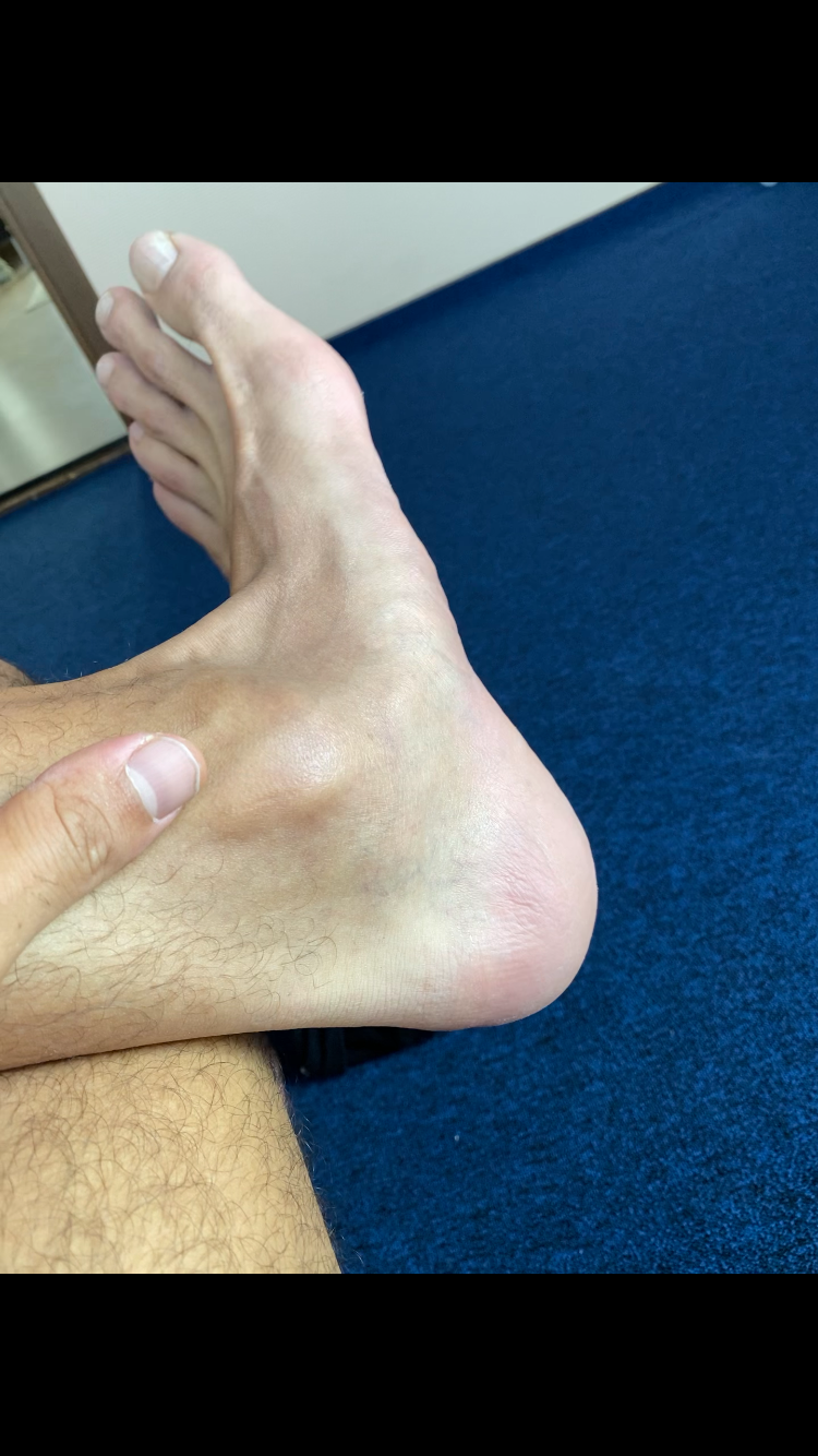 Thumbnail: Video 1 - Nizar shows his size 15 US feet after practice 