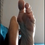 Thumbnail: Simon shows his size 17 US feet and soles