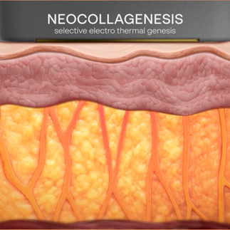 Skin before XERF (and neocollagenesis)