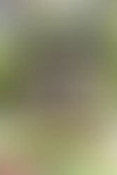 Skin is your Largest Organ. What have you done to Protect it?