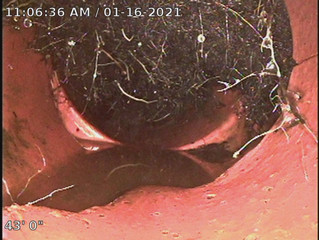 How to Tell If Tree Roots Are Growing In Your Sewer Pipes