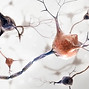 nervos-comprimidos-dor-neuropaticaimagem-do-site-dra-julie-azevedo