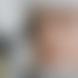 Göz Sağlığında Dijital Ekran Tehlikesi: '20-20-20' Kuralını İhmal Etmeyin