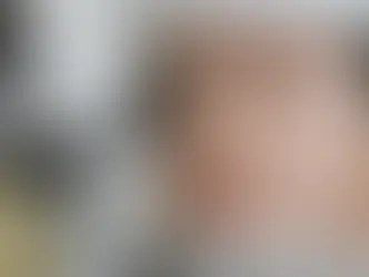 Göz Sağlığında Dijital Ekran Tehlikesi: '20-20-20' Kuralını İhmal Etmeyin