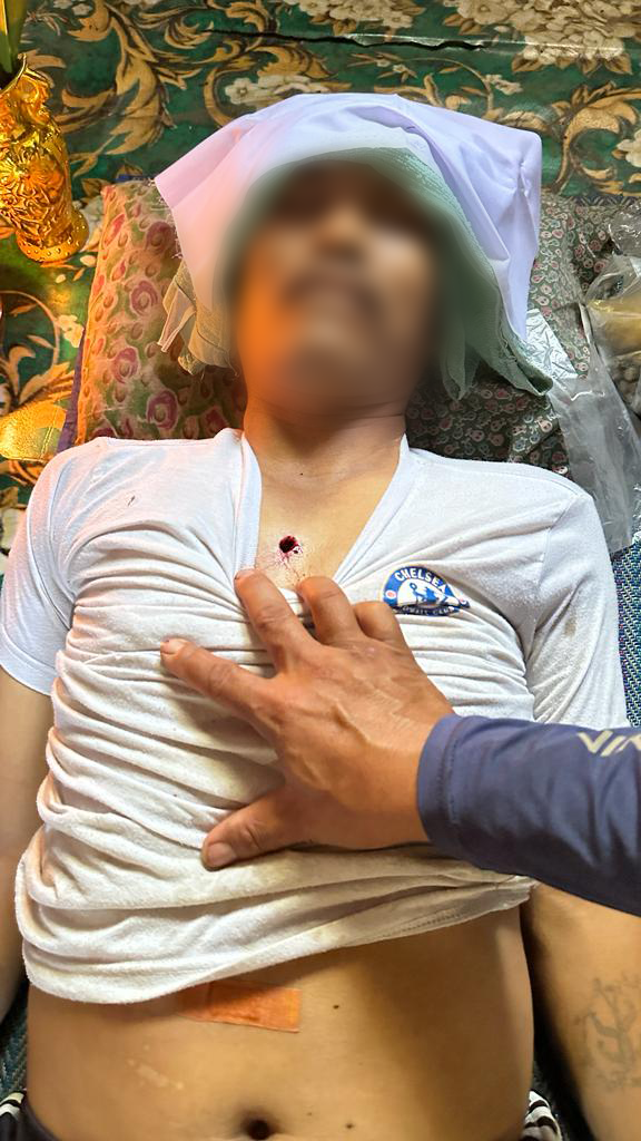 Man shot to death by the Burma Army.