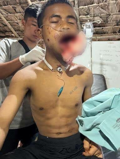 Prepping patient for transport to hospital.