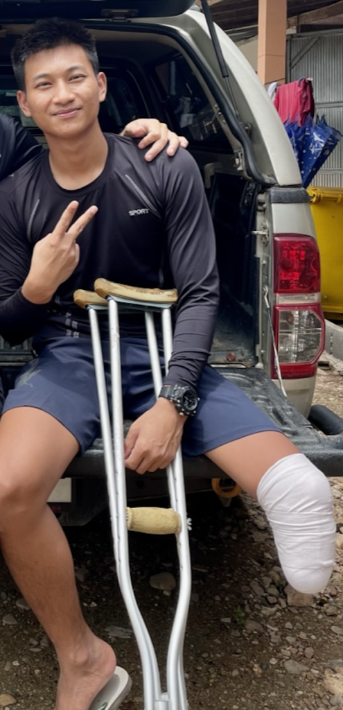 Aung Thu waiting for his latest surgery to heal before getting his new leg.