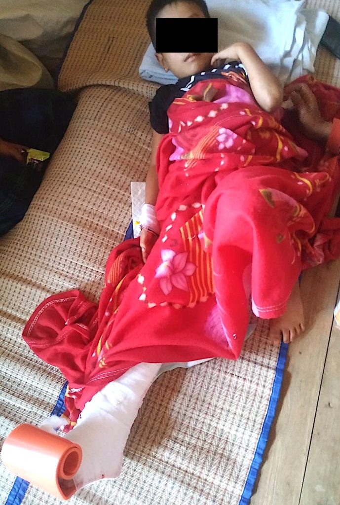 Six year old severely wounded