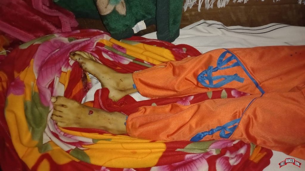 Luiz’s feet were also hit with shrapnel when the mine went off. 