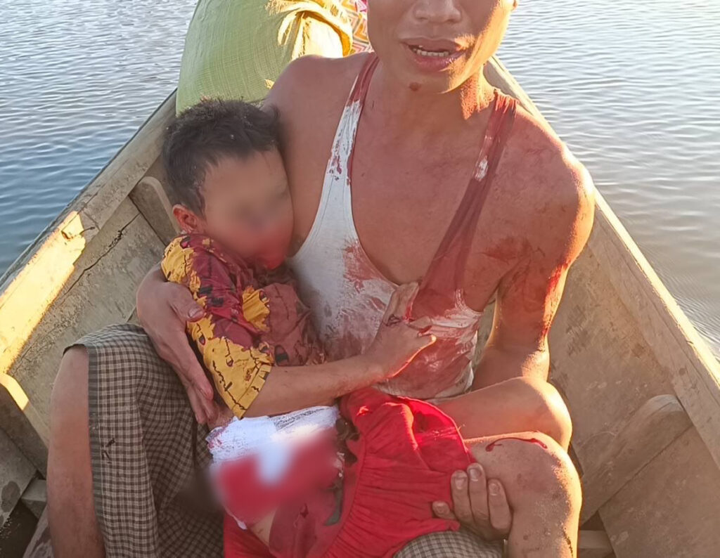 A man holds his son who was injured by 155mm howitzer rounds launched by the Burma Army.