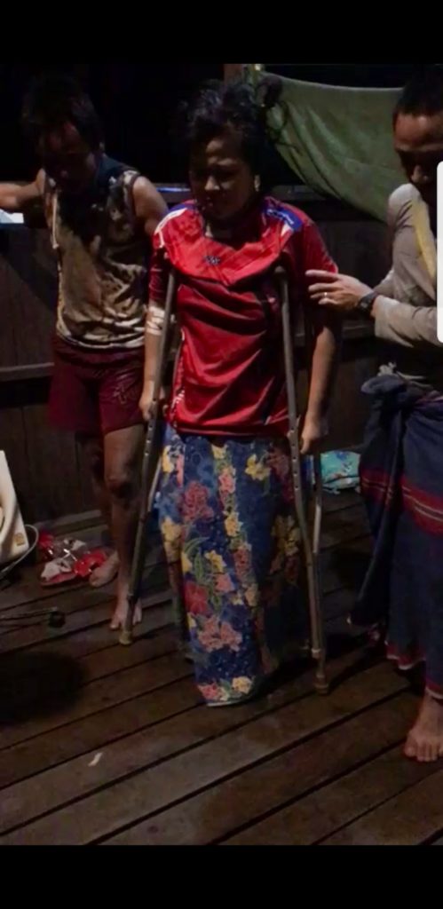 Na Day Mu walks with crutches