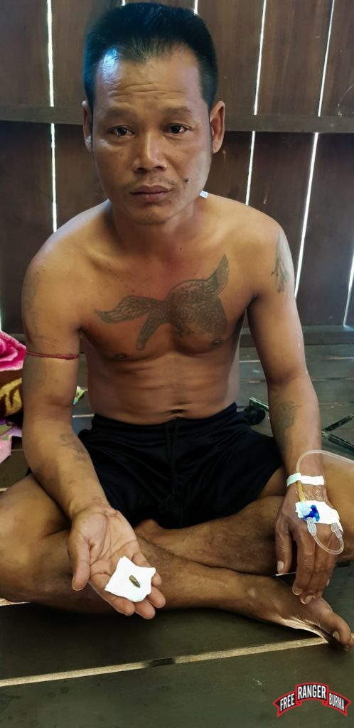 Patient holding the bullet intended to kill him by the Burma Army.