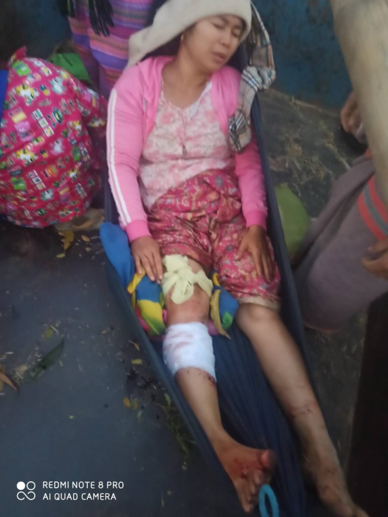36-year-old Ba Tha Tha was wounded in her calf by a Burma Army mortar on February 11.