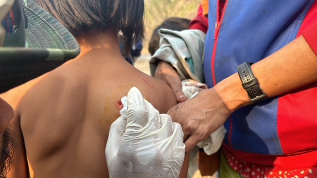 Seven-year-old girl being treated for shrapnel wound.
