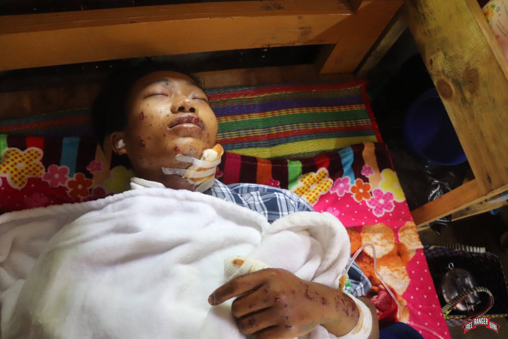 Sawa Rumi resting at Luke hospital after being treated for his landmine injury.