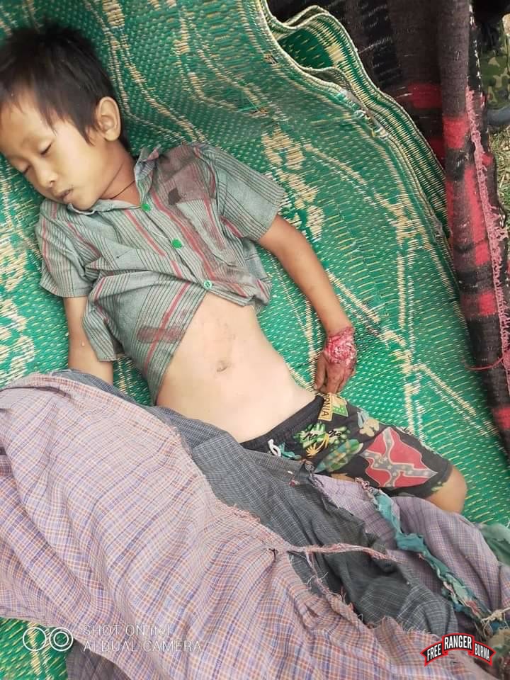 The body of eight year old Mg Kennedy after being shot by Burma Army. 