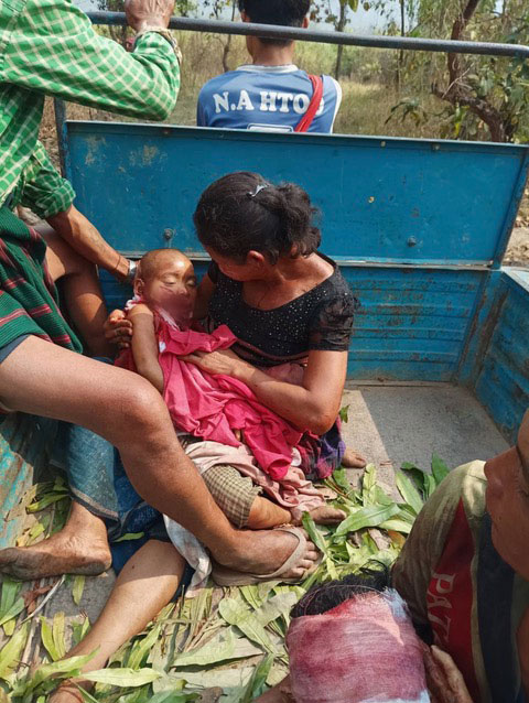 7-year-old Naw Win Win, hit in the face and killed by Burma Army mortars.