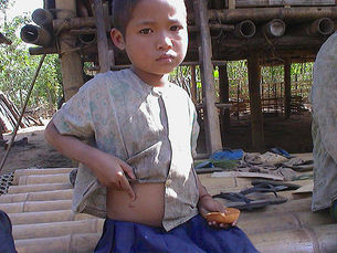 “Do you remember me?” A Follow-Up Report on an 8-Year-Old Girl Shot by the Burma Army