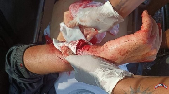 Motorbike with blood and Mg Win Ko Ko Naing's injured wrist.