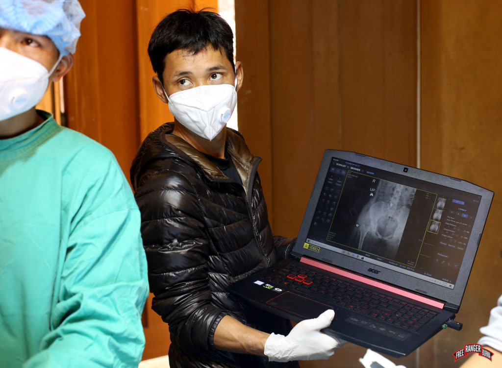 Locating the shrapnel with x-ray