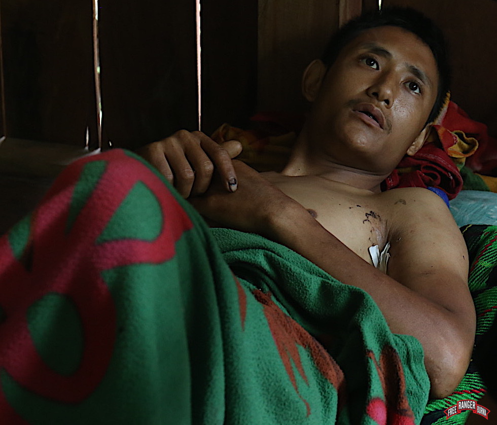 Saw Kit Mae, 32, being treated for his wounds.