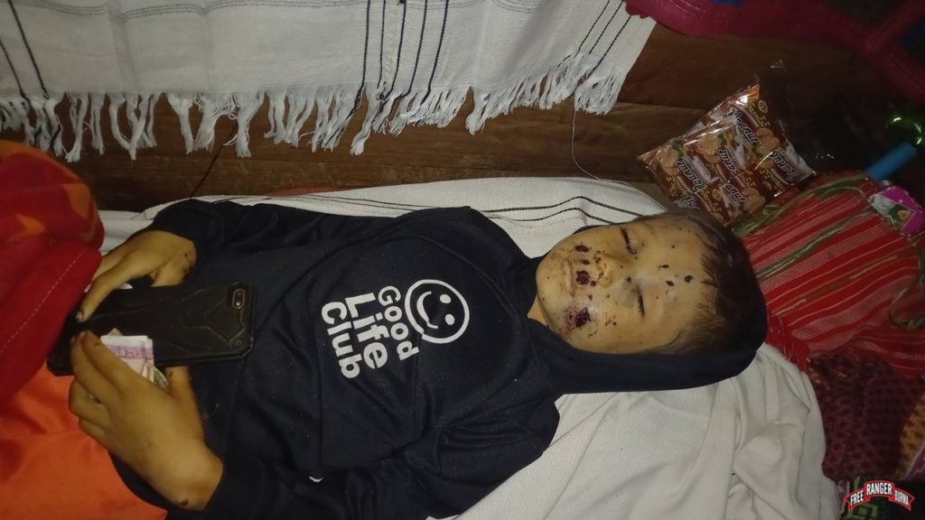 Body of eight year old Luiz Zi, shrapnel wounds in his face and Good Life Club shirt on. 