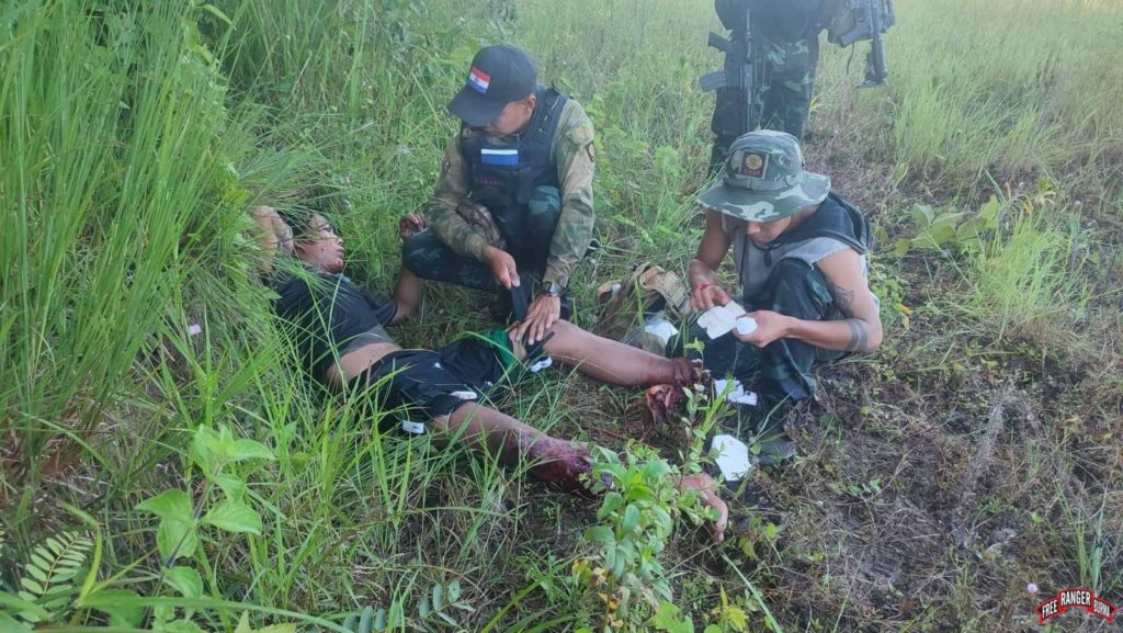 Sawa Rumi, 19 years old, after he stepped on a landmine.